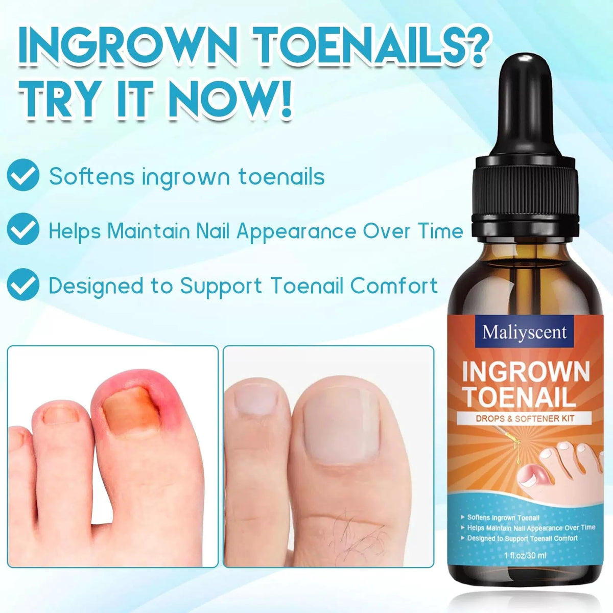 Ingrown Toenail Removal Kit, Professional 1 Fl Oz (Pack of 1), Silver [3]