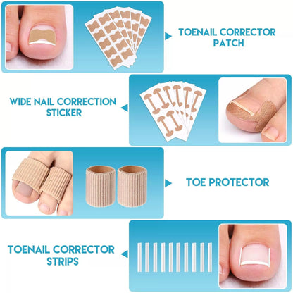 Ingrown Toenail Removal Kit, Professional 1 Fl Oz (Pack of 1), Silver [4]