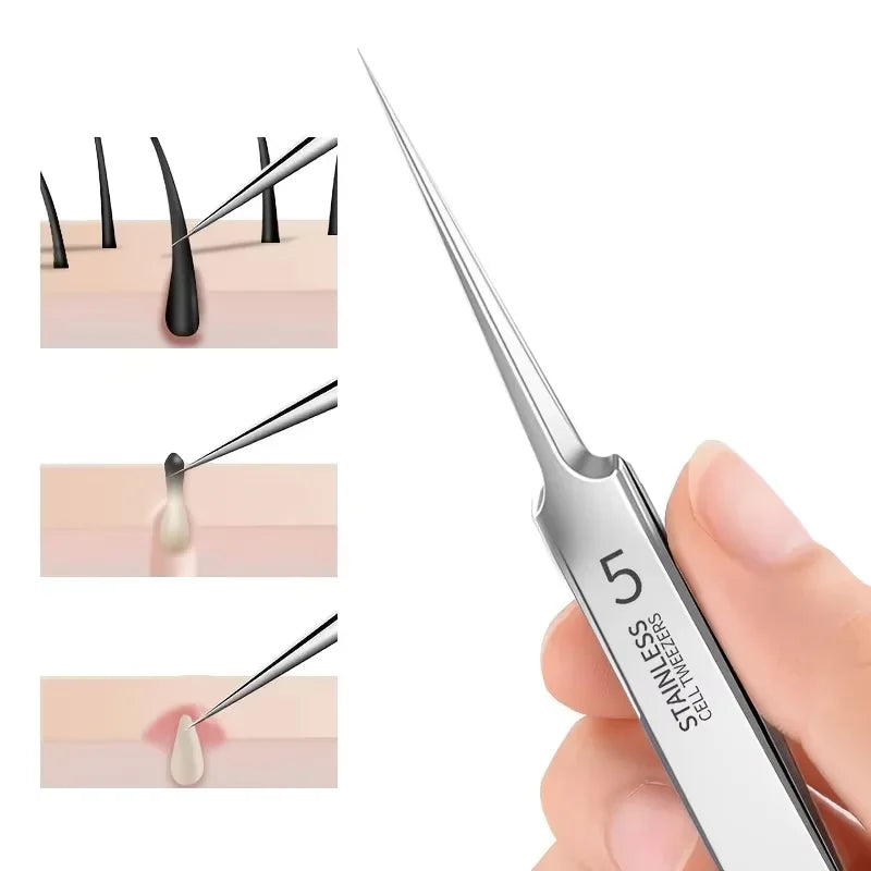 Beauty Salon Special Ultra-Fine No. 5 Cell Acne Clip High-Quality Multi-function Tweezers Professional Acne Needle Care Tools