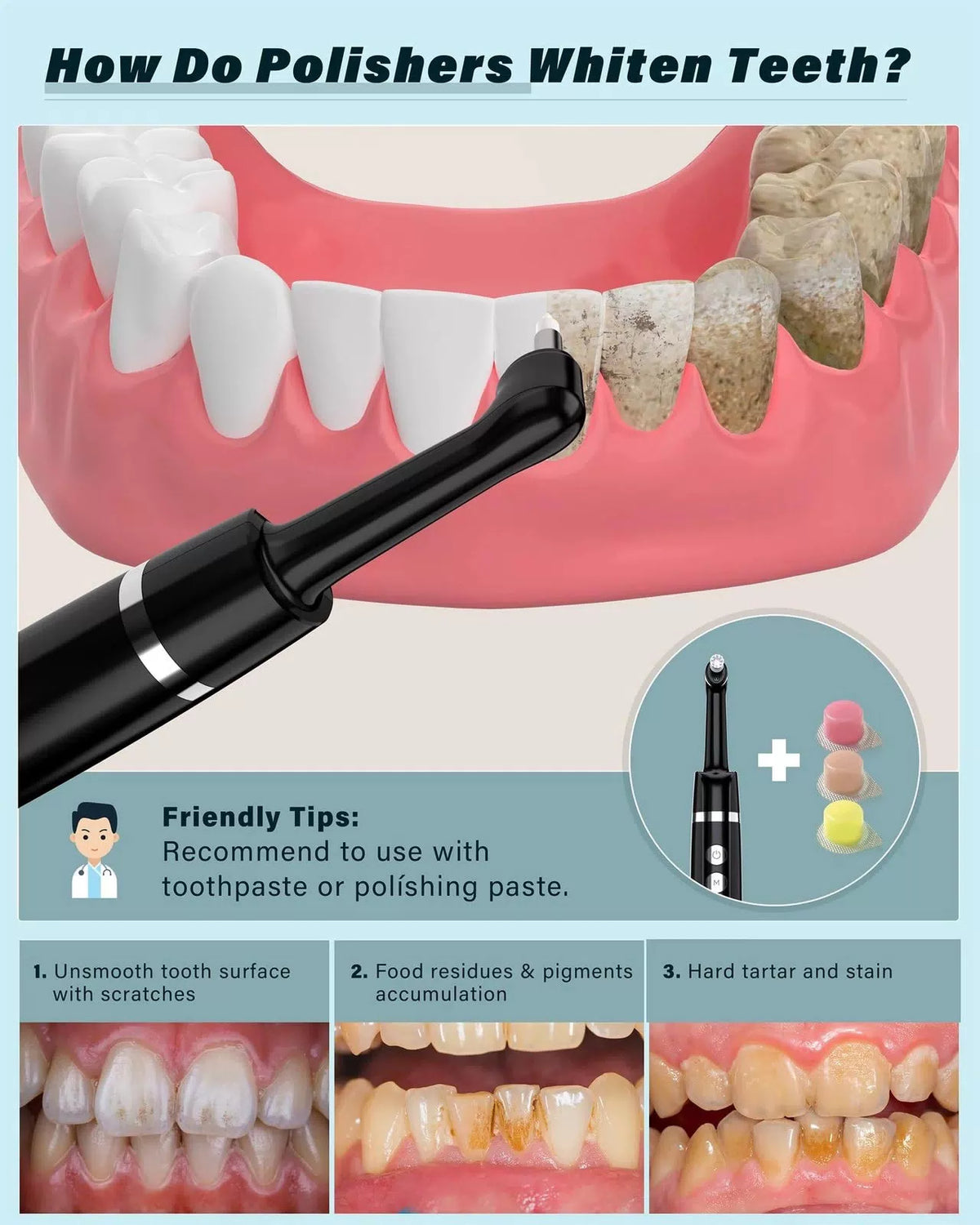 Tooth Polisher, Rechargeable Whitening Kit 1 Ounce (Pack of 1), Black [2]