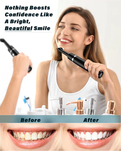 Tooth Polisher, Rechargeable Whitening Kit 1 Ounce (Pack of 1), Black [5]
