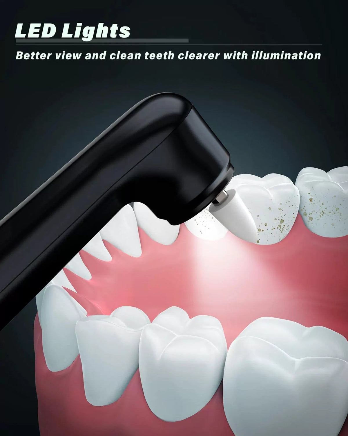 Tooth Polisher, Rechargeable Whitening Kit 1 Ounce (Pack of 1), Black [7]