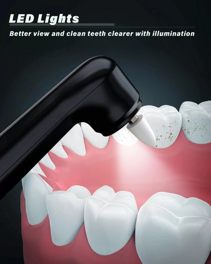 Tooth Polisher, Rechargeable Whitening Kit 1 Ounce (Pack of 1), Black [7]