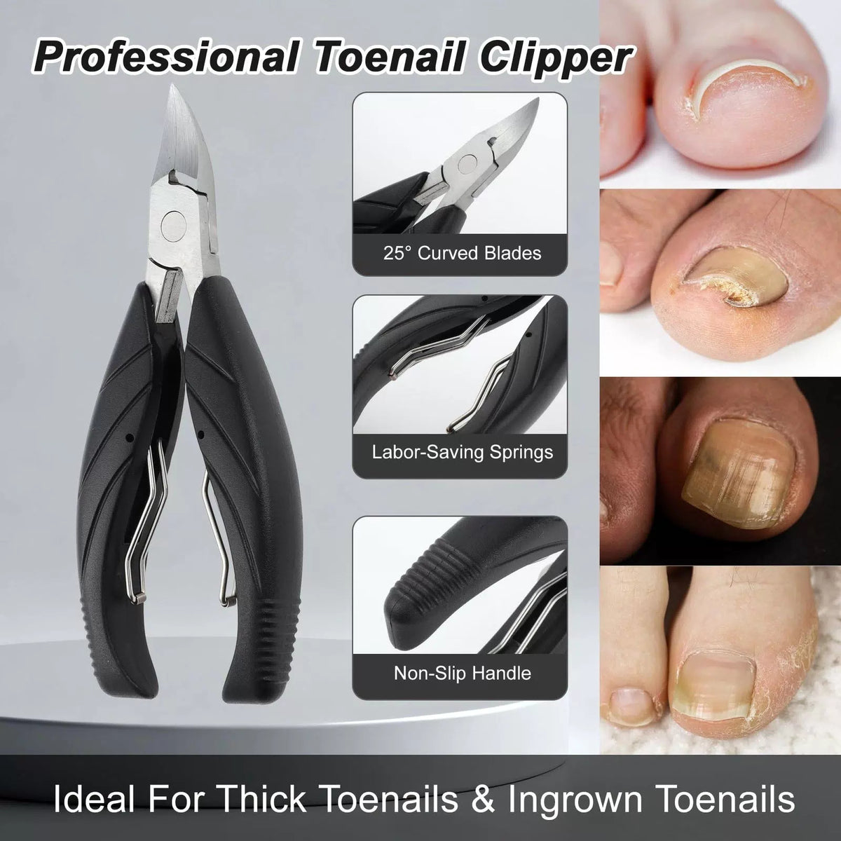 VOCOSTE 13Pcs Ingrown Toenail Kit Black [2]