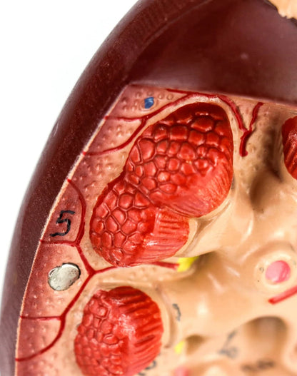 QWORK Life-Size Kidney Model, Divided into 2 Parts Showing Internal...