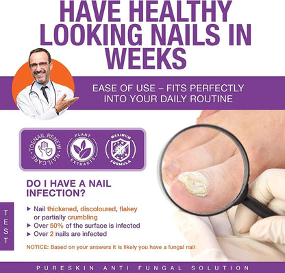 Toenail Fungus Treatment Extra Strength Kit, 1 Fl Oz (Pack of 1), Purple