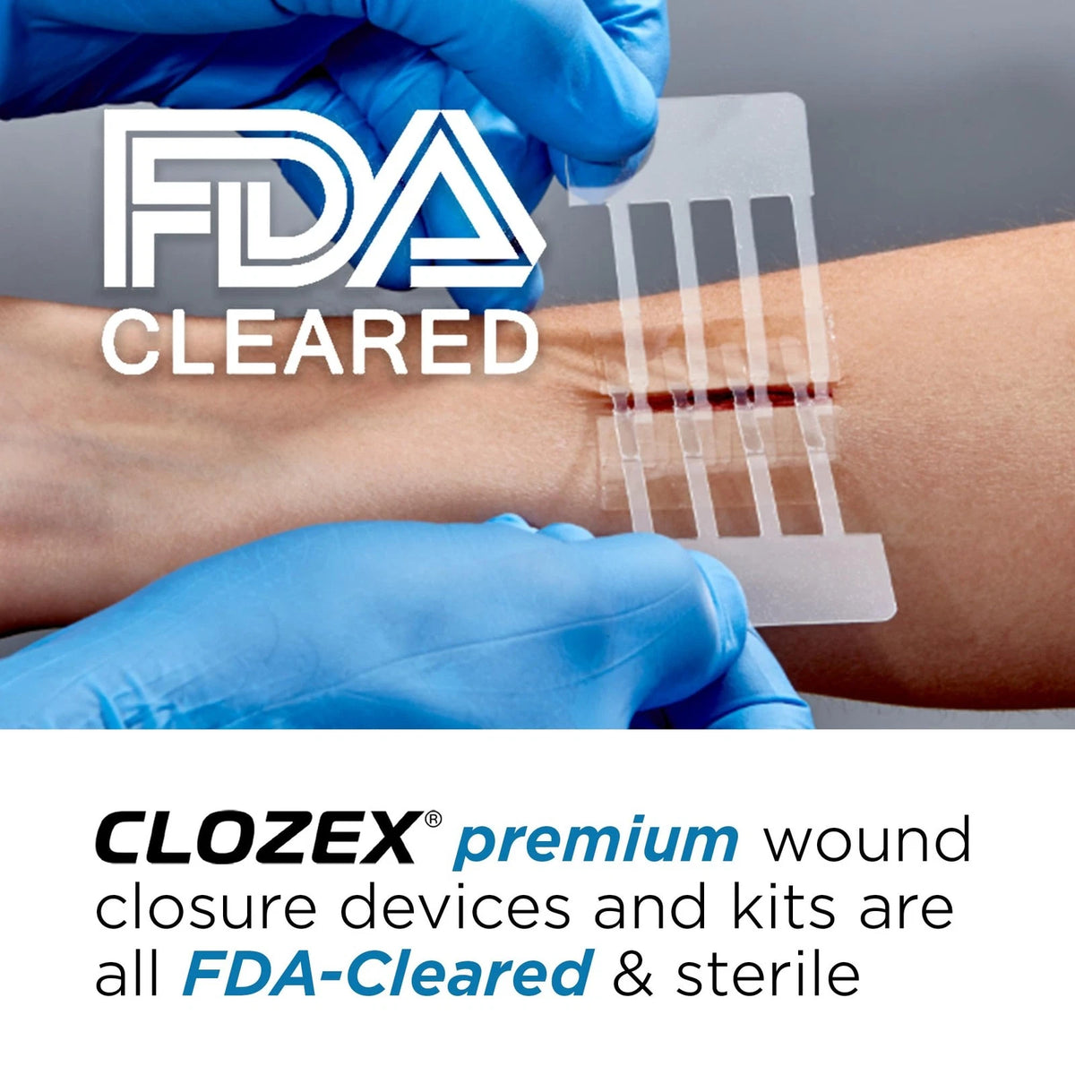 Clozex Emergency Laceration Kit - Repair Wounds Without Stitches, 1.5 Inch