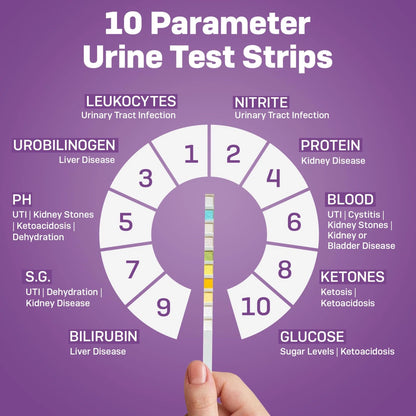 One Step Pet Urine Testing Strips, 5 x Urinalysis 10 5 Count (Pack of 1)