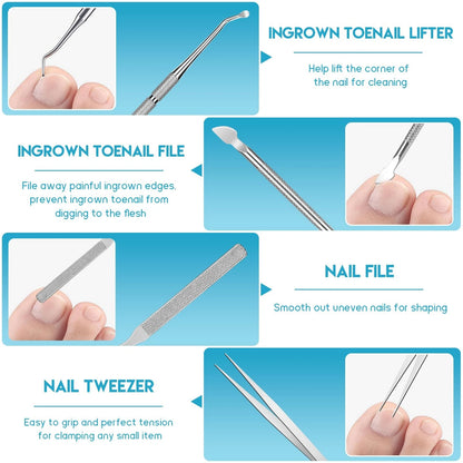 Ingrown Toenail Removal Kit, Professional 1 Fl Oz (Pack of 1), Silver
