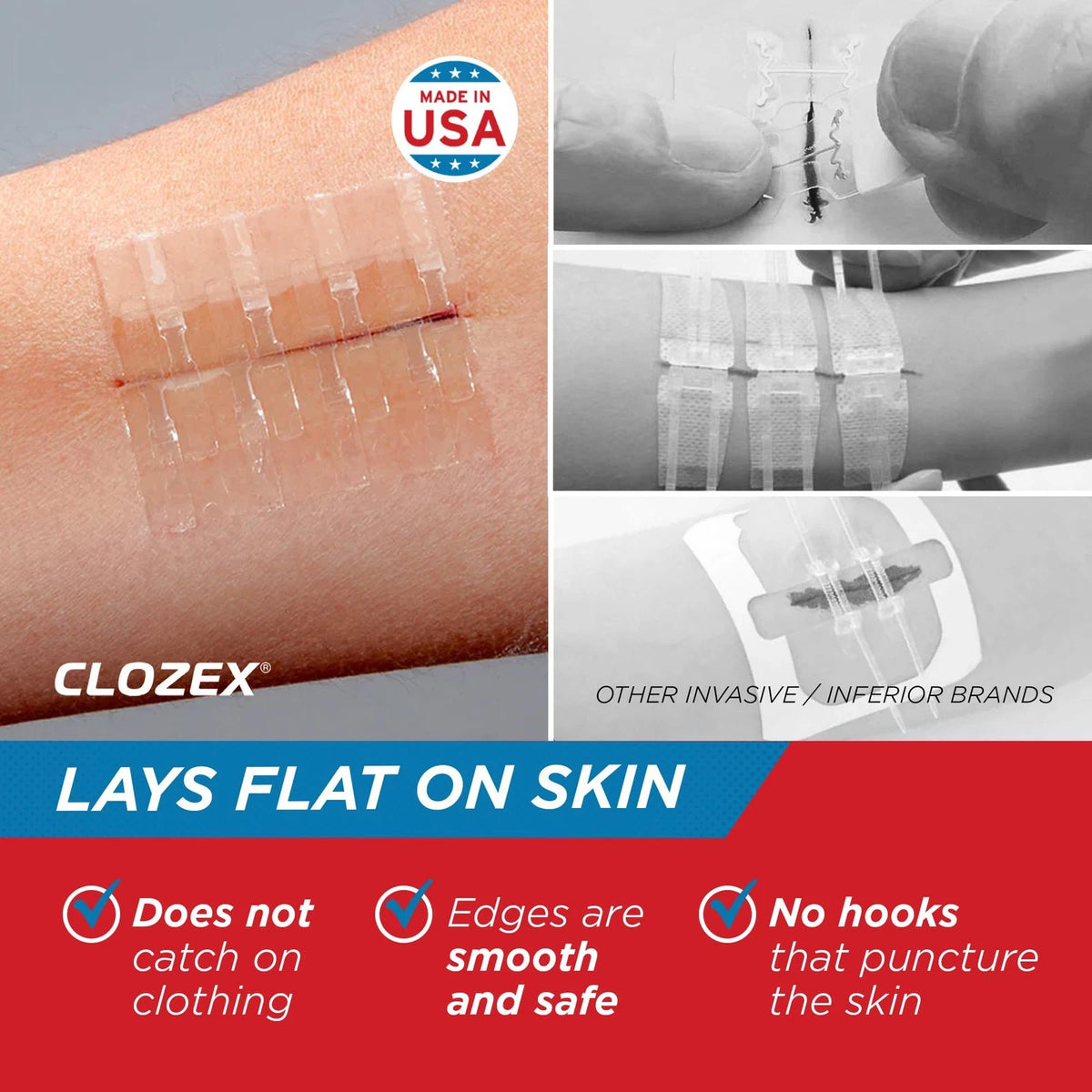 Clozex Emergency Laceration Kit - Repair Wounds Without Stitches, 1.5 Inch
