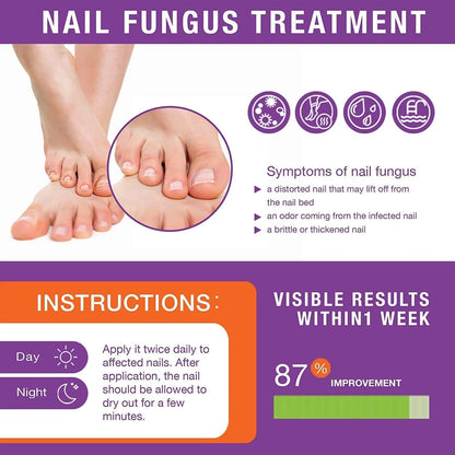 Toenail Fungus Treatment Extra Strength Kit, 1 Fl Oz (Pack of 1), Purple