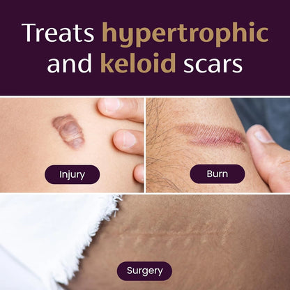 Mederma Medical Grade Silicone Scar Sheets; Improves The Appearance of Small
