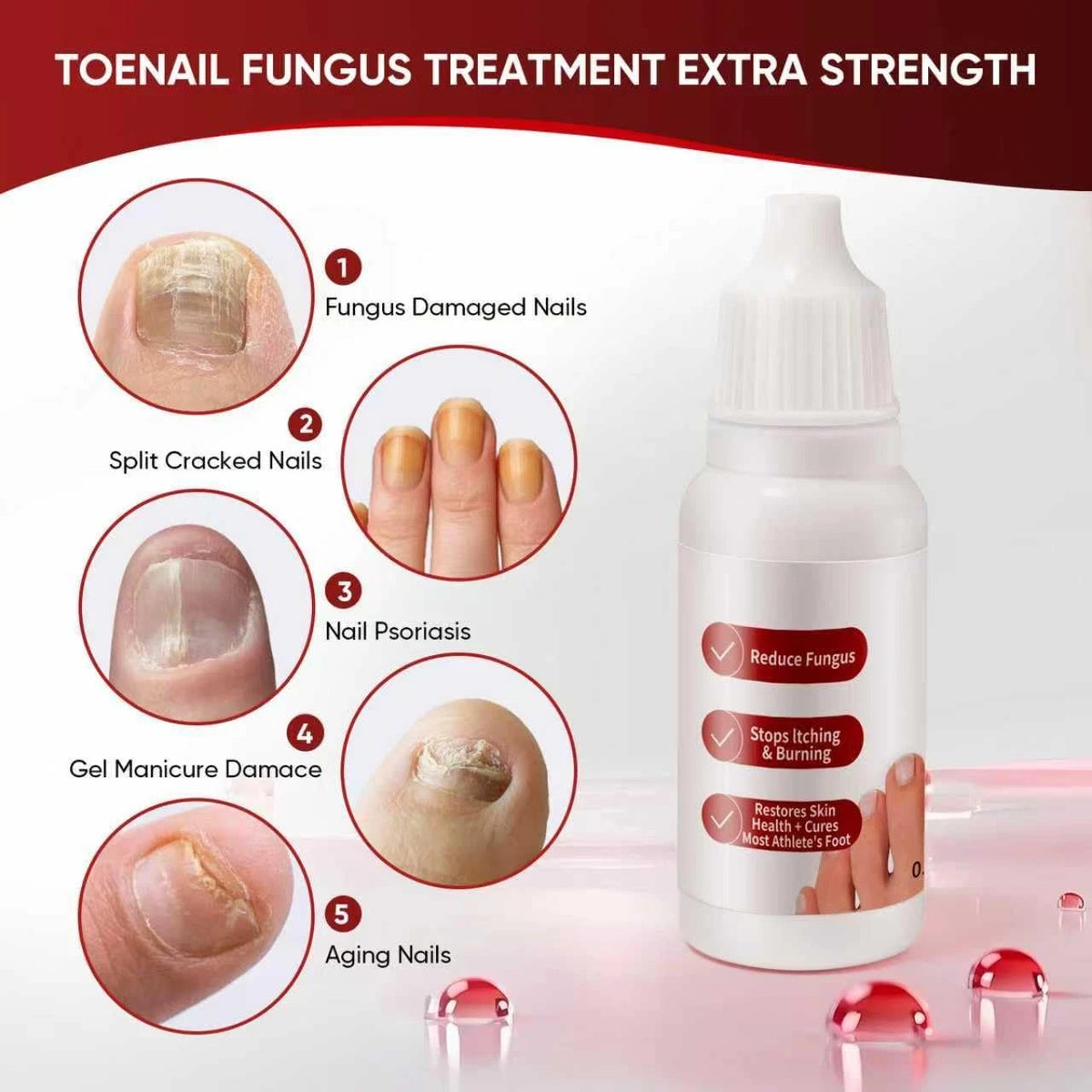 DERMFREE Toenail Treatment,Gentle Formula, 0.5 Fl Oz (Pack of 1), red
