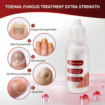 DERMFREE Toenail Treatment,Gentle Formula, 0.5 Fl Oz (Pack of 1), red