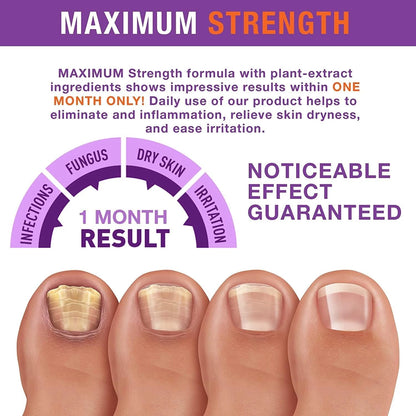 Toenail Fungus Treatment Extra Strength Kit, 1 Fl Oz (Pack of 1), Purple