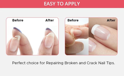 Professional Nail Repair Kit for Broken Cracked Split and 1 Count (Pack of 1)