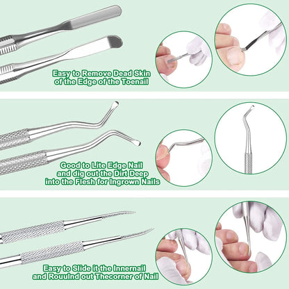 6-Pack Ingrown Toenail File and Lifters, Professional 6 Piece Set, 6-pack