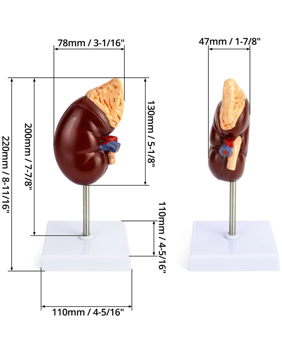 QWORK Life-Size Kidney Model, Divided into 2 Parts Showing Internal...
