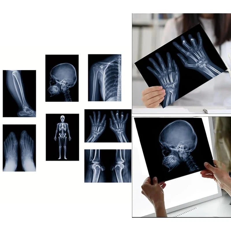 X-ray Science Education Package for Human Anatomy 8.3 inches by 11.7