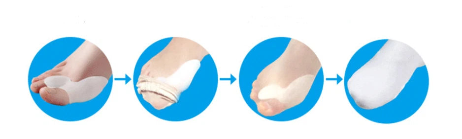2X Silicone Gel Bunion Toe Protector Straightener Corrector Spreader Splint Pads