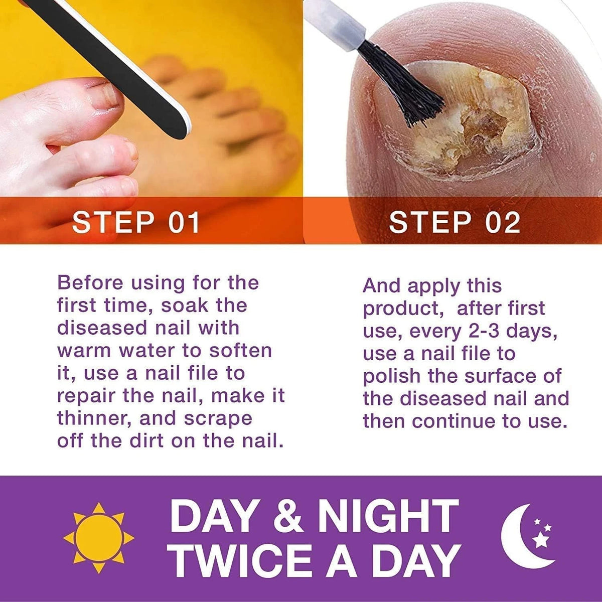 Toenail Fungus Treatment Extra Strength Kit, 1 Fl Oz (Pack of 1), Purple