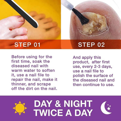 Toenail Fungus Treatment Extra Strength Kit, 1 Fl Oz (Pack of 1), Purple